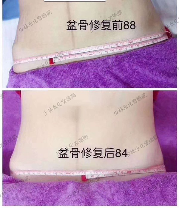   ���������îa(ch��n)���(xi��ng)Ŀ-�����ޏ�(f��)