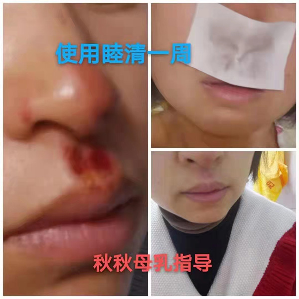 �����澏���N���Æ᣿���M�߿ڱ������������a(ch��n)ƷȦ�۟o��(sh��)